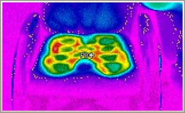 Thermo-graphic Imaging